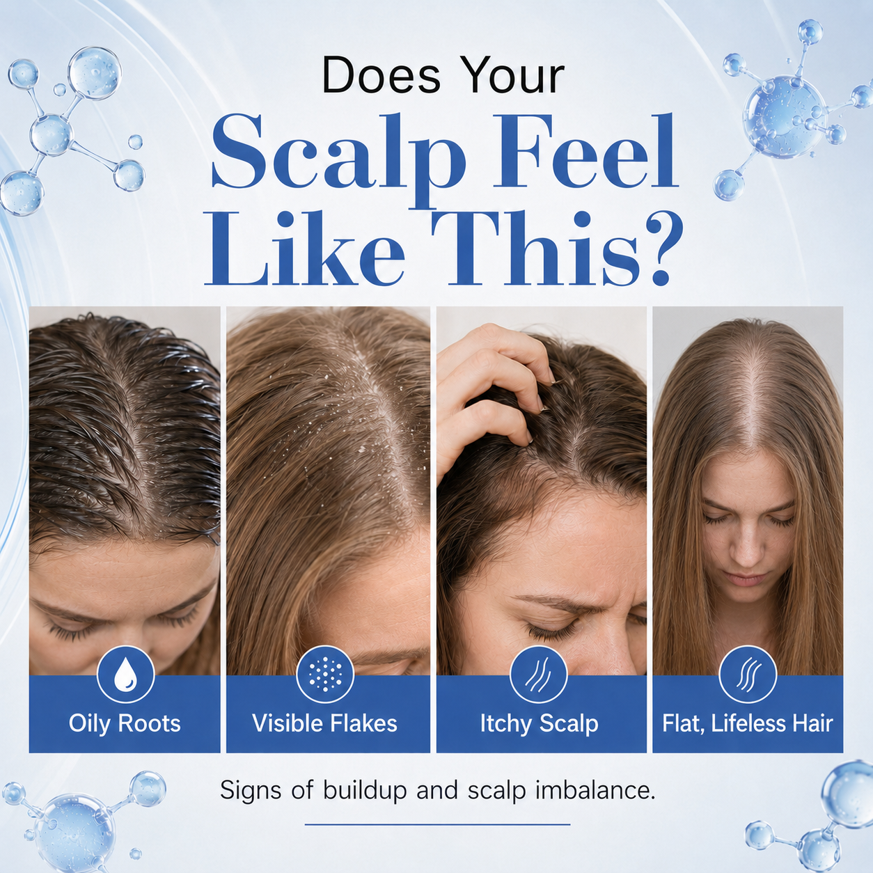 Zyvarn Scalp Nourishing Shampoo - CYH