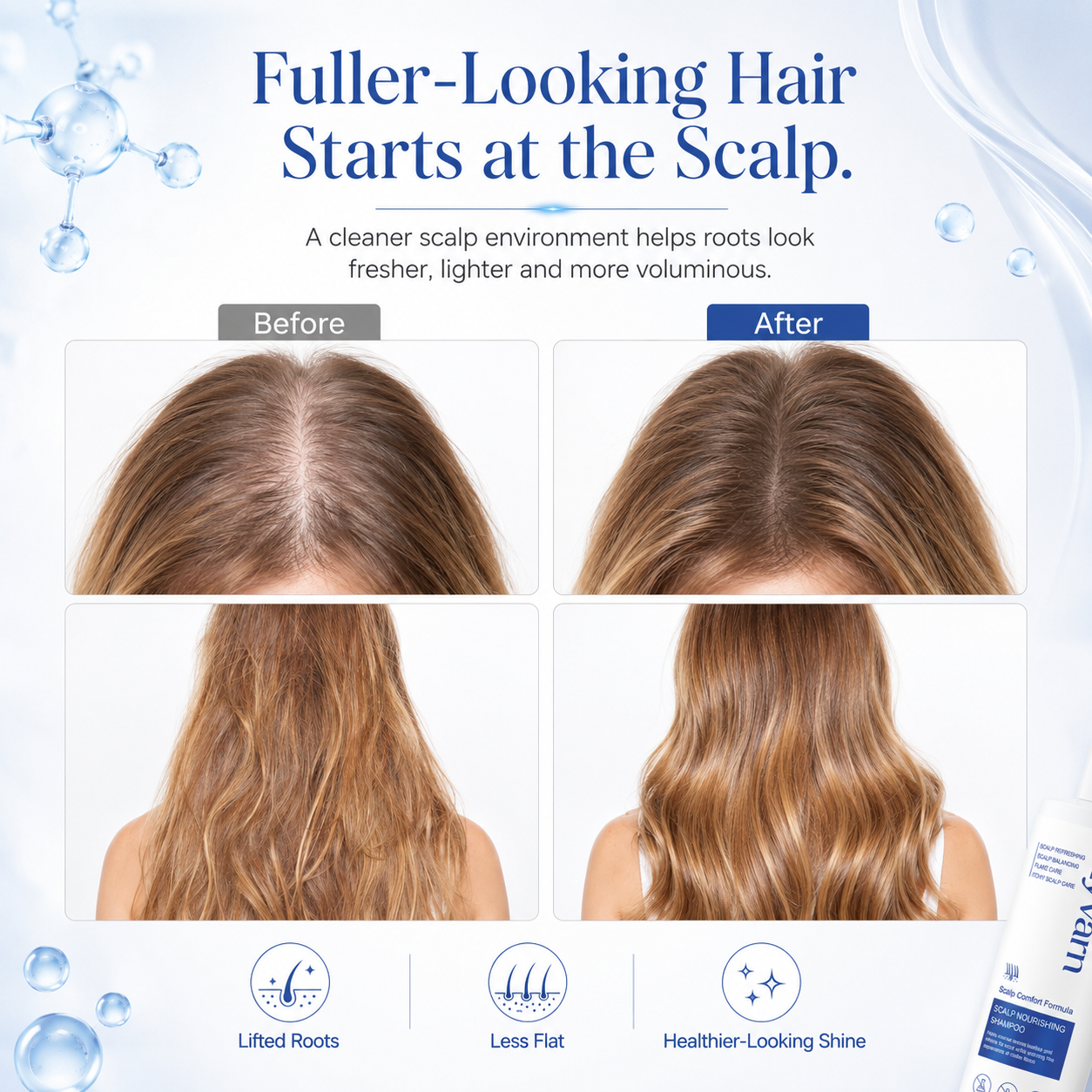 Zyvarn Scalp Nourishing Shampoo - CYH