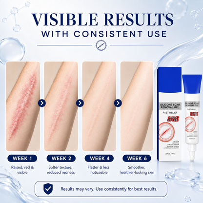 Advanced Silicone Scar Repair Gel - CYH