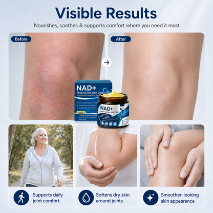 NAD+ Advanced Joint Relief Cream – Cooling Comfort for Neck, Shoulders, Back, Knees & More - CYH